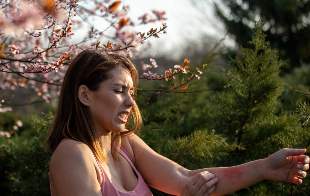 istock Girl itching arm as allergy symptom 1309570412