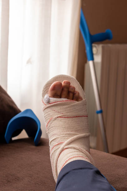istock man with broken foot, leg in a cast. Man with crutches. 1309591658