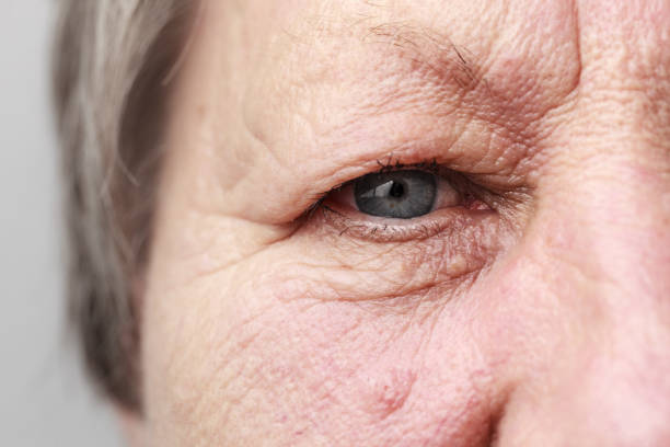 istock Elderly pensioner female eye closeup 1309720260