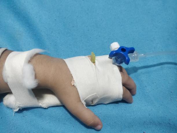 primer plano del brazo de la niña con infusión en el hospital - morfina medicamento fotos fotografías e imágenes de stock