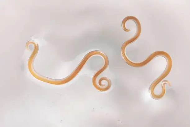 Photo of Parasitic nematode fish worm
