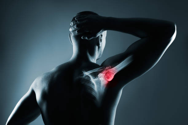 istock Human shoulder joint in x-ray on gray background 1309784090