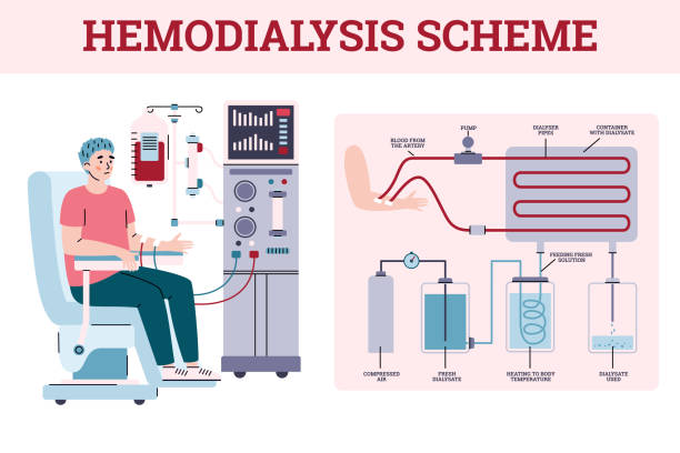Hemodialysis renal scheme with equipment for treatment kidney diseases failure Hemodialysis renal scheme with equipment for treatment kidney chronic diseases failure for patients. Concept of medicine and health care. Vector medical banner with text. dialysis stock illustrations