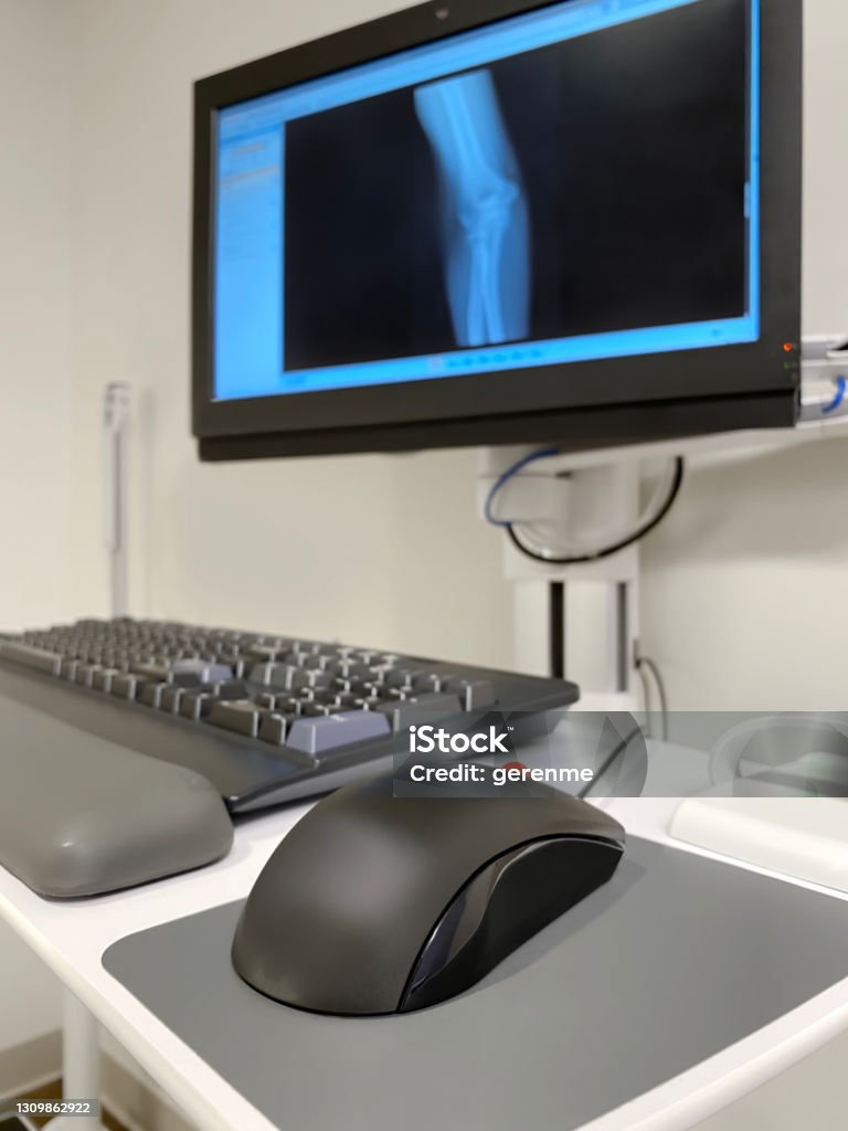 Doctor's office Computer monitor with xray results in doctor’s office 3D Scanning Stock Photo