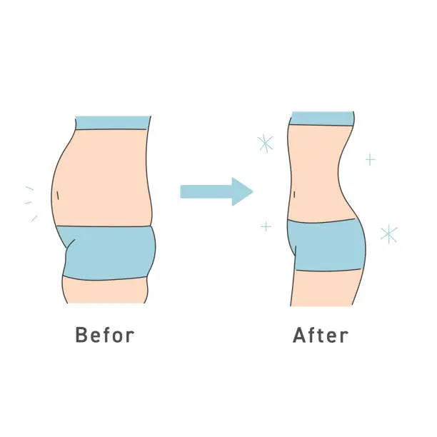 Vector illustration of Illustration of before and after waist of a woman on a diet