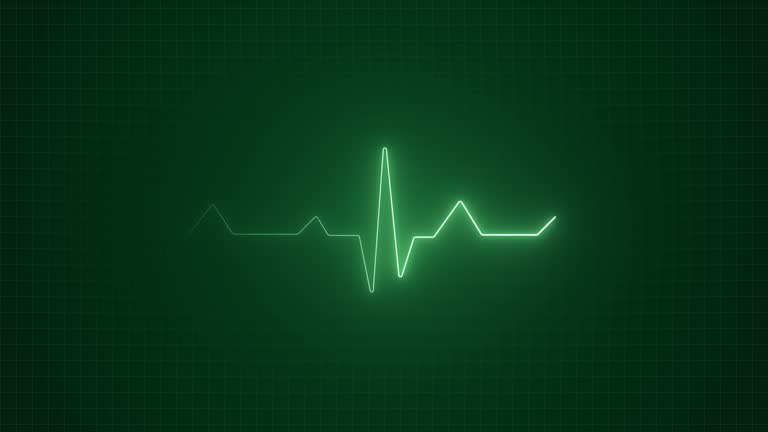 Heart beat chart on the monitor 4 Free Stock Video Footage Download Clips pulse trace Heart beat chart on the monitor 4 Free Stock Video Footage Download Clips pulse trace