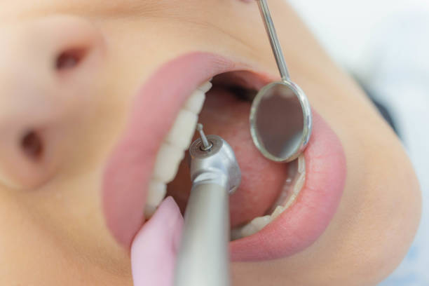 istock Woman having teeth examined at dentists 1309887861