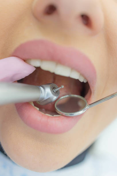 istock Woman having teeth examined at dentists 1309887864