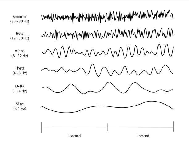 przebiegi eeg (elektroencefalogram). - electrode stock illustrations