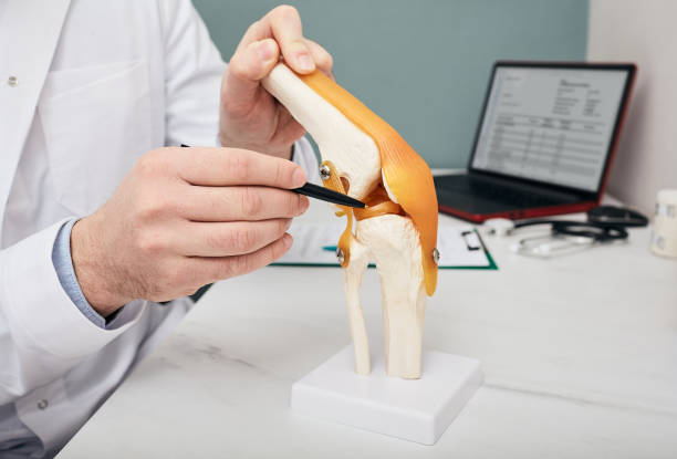 무릎 관절 해부학 교육 모델, 클로즈업에서 반월 상 연골펜을 가리키는 외상학자. 인간 찢어진 반월 상 연골 치료 개념 - cartilage patella human knee medical exam 뉴스 사진 이미지