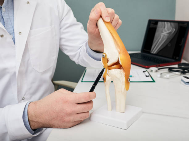 concepto de tratamiento de lesiones por ligamento cruzado humano. ortopedista mostrando ligamento cruzado en un modelo de enseñanza médica rodilla-articulación, primer plano - cruciate ligament fotografías e imágenes de stock