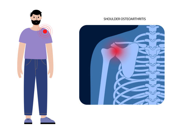 ilustraciones, imágenes clip art, dibujos animados e iconos de stock de concepto de dolor de hombro - rheumatic