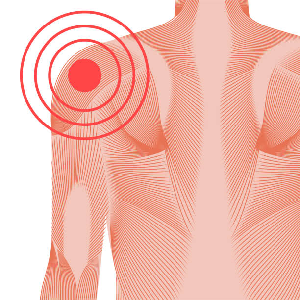 ilustrações de stock, clip art, desenhos animados e ícones de shoulder pain concept - deltoid