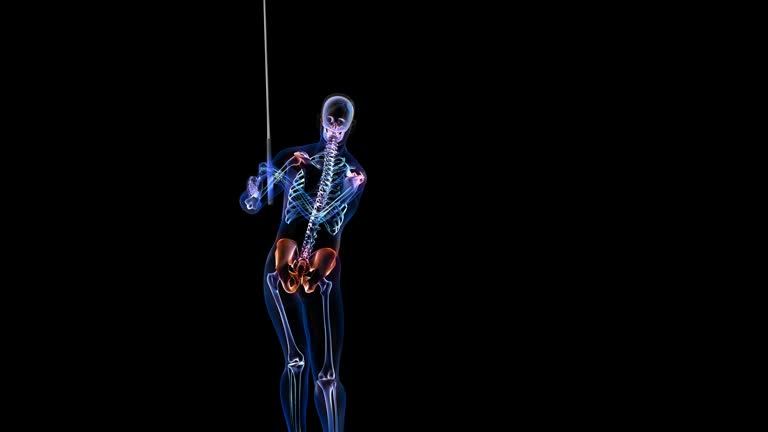 748 Medical Stroke Animation Stock Videos and Royalty-Free Footage - iStock | Heart bypass surgery 748 Medical Stroke Animation Stock Videos and Royalty-Free Footage - iStock | Heart bypass surgery