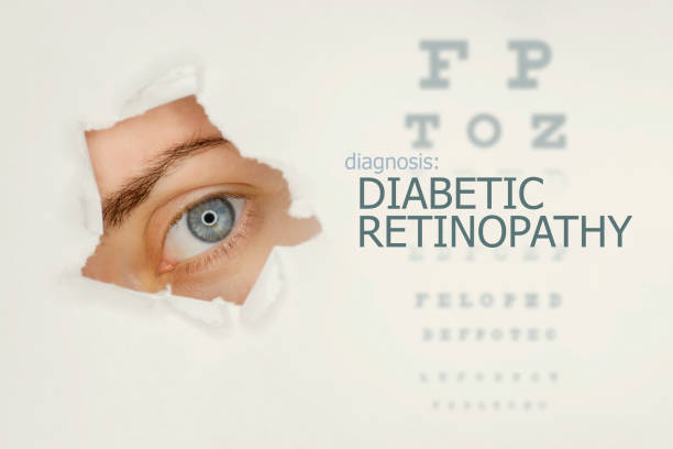 ojo de la mujer mirando a través de agujero rasgado en papel, prueba ocular con palabras retinopatía diabética a la derecha. - teared fotografías e imágenes de stock