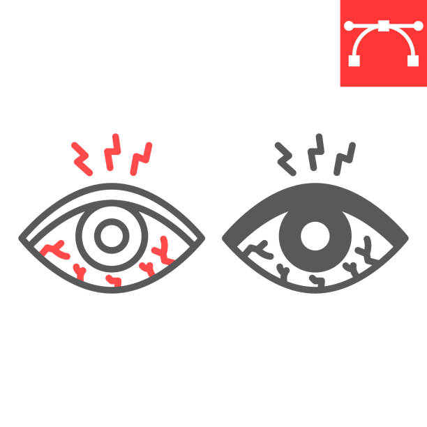 kuvapankkikuvitukset aiheesta silmä kipeä viiva ja merkki kuvake, sairaus ja allergia, silmien punoitus vektori kuvake, vektorigrafiikka, muokattava aivohalvaus ääriviivat merkki, eps 10. - turvonnut