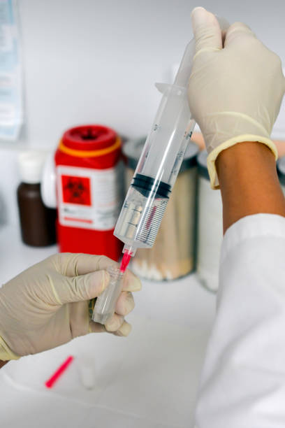 istock Drawing up Biological Allograft 1310457184