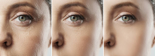 istock Female face after incredible rejuvenation process or heavy retouching 1310462566