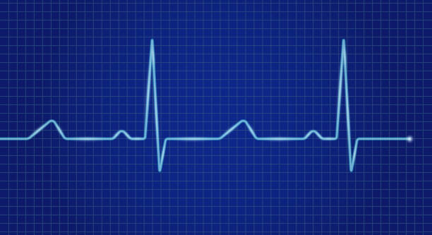 istock Cardiogram cardiograph oscilloscope blue screen. Heartbeat line. Vector illustration 1310518228