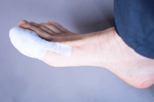 pied grand bandage d’pied blessé pieds dans le centre hospitalier clinique médicale. - big toe photos et images de collection