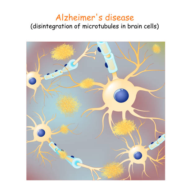 bildbanksillustrationer, clip art samt tecknat material och ikoner med alzheimers sjukdom. demens. vektor bakgrund med nervceller och amyloid plack - amyloid