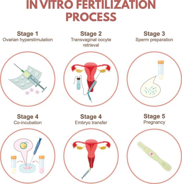 ilustrações, clipart, desenhos animados e ícones de fertilização in vitro - retrieval