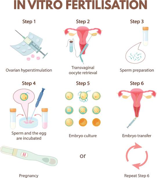 in-vitro-fertilisation - retrieval stock-grafiken, -clipart, -cartoons und -symbole