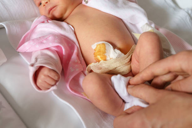 istock Baby lying down on bed at home while unknown man her father is changing her clothes dressing or undressing with navel wrapped and cleaned - parenthood and care concept 1310819648