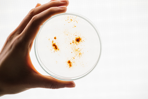 Unrecognizable microbiologist holding a Petri dish with yellow specimens