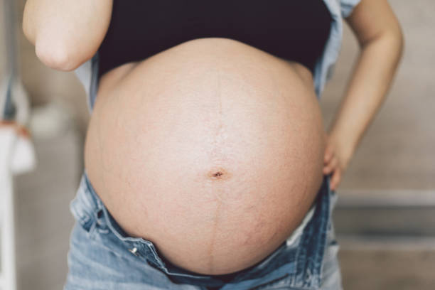 11,100+ Enormous Pregnant Belly Stock Photos, Pictures & Royalty-Free