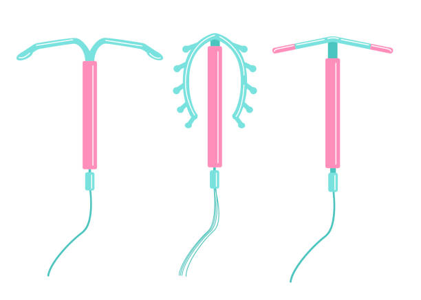 iud避妊の方法は孤立していない。妊娠のコントロールと保護。子宮内装置。フラットスタイルのベクトルイラストレーション。 - iucds点のイラスト素材／クリップアート素材／マンガ素材／アイコン素材