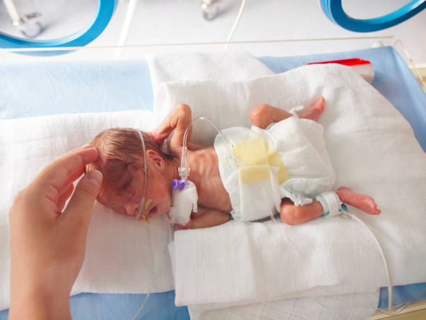 Preterm baby in NICU