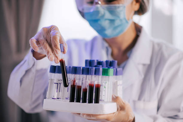 Asian chinese cosmetologist does prp therapy and working on platelet-rich-plasma therapy using centrifuge machine holding blood collection tube selective focus of nurse holding blood tube and looking on it human blood stock pictures, royalty-free photos & images