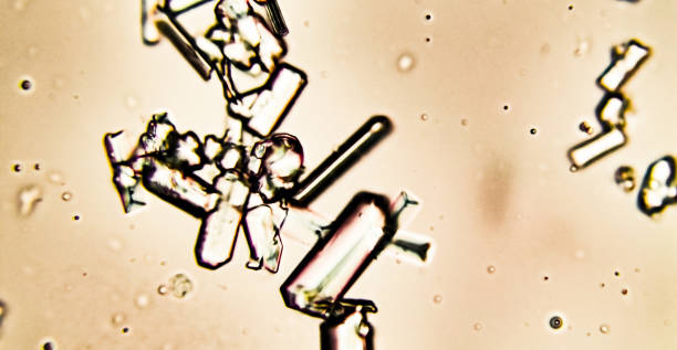 尿沈込からのオキ酸カルシウムおよびヒッププリン酸結晶の顕微鏡図 - 顕微鏡 写真 ストックフォトと画像