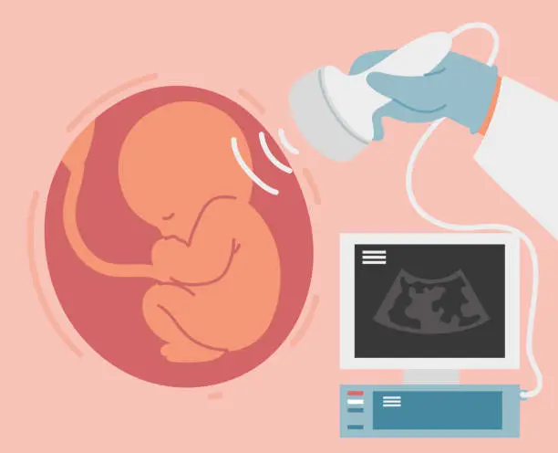 Vector illustration of ultrasound scan of baby