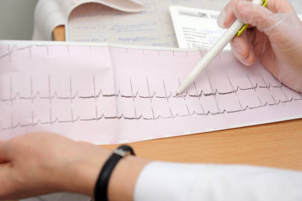 The doctor looks at the cardiogram of the heart on paper. The doctor looks at the cardiogram of the heart on paper. stress test stock pictures, royalty-free photos & images