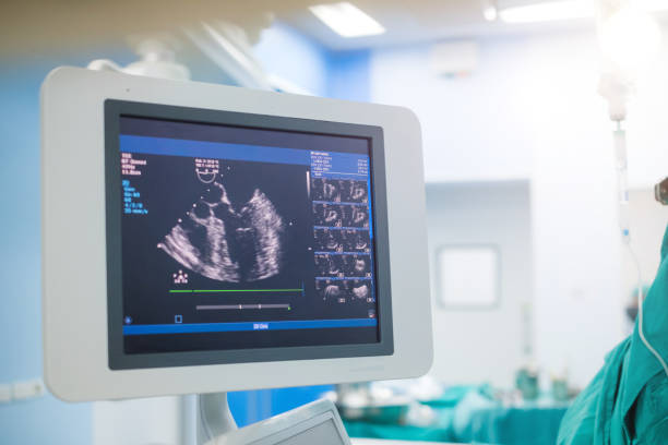 Doctor is examining heart's patient by echocardiogram for diagnosis disease or explain symptom. Medical exam , ultrasound. Medical equipment. stock photo