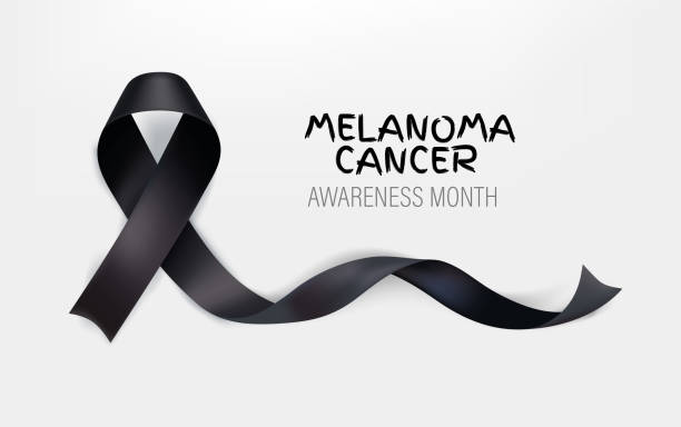 istock Melanoma awareness month banner. Black ribbon and inscription 1311503656