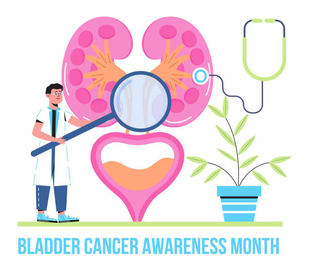 istock Bladder cancer awareness month concept vector. Event celebrated in May. Info-graphic of pyelonephritis, diseases. Kidneys, cystitis, bladder icons. Nephropathy, renal failure 1311913325