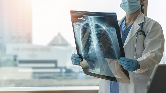 Enfermedad pulmonar, covid-19, asma o enfermedad del cáncer óseo con médico diagnosticando la salud del paciente con película radiológica de rayos X en el pecho para el servicio médico de hospital de salud photo