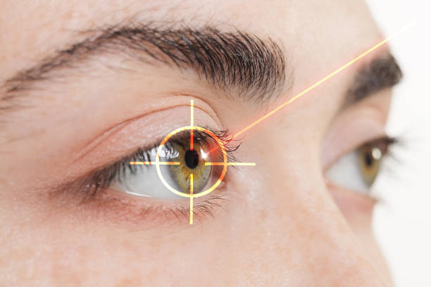여성 녹색 눈 클로즈업. 레이저 빔은 눈의 홍채를 지향합니다. 측면 ��보기입니다. 레이저 시력 보정의 개념 - 안과의사 뉴스 사진 이미지