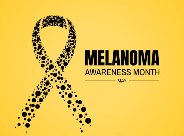Melanoma Cancer Awareness Month banner. Melanoma Cancer Awareness Month banner. Symbol of the fight against melanoma cancer. melanoma stock illustrations