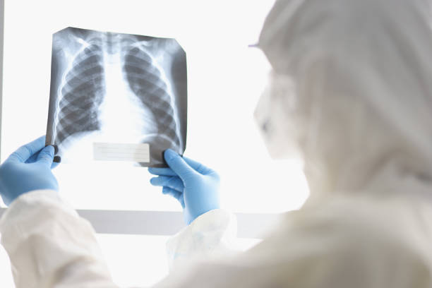 istock Doctor in protective suit examines X-ray closeup 1312130747