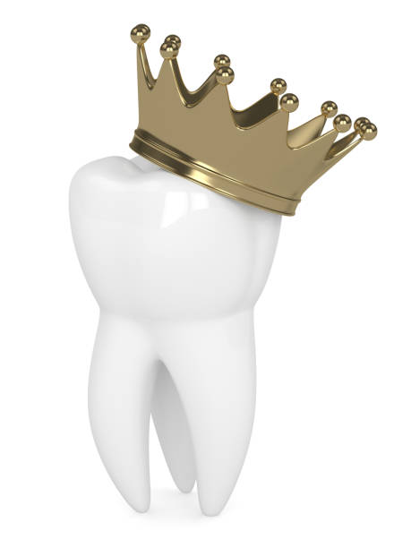 istock 3d render of tooth in crown over white 1312130785