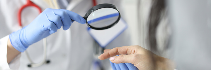 Dermatologist doctor looking at patients skin on hands using magnifying glass in clinic closeup. Diagnosis of fungal skin diseases concept