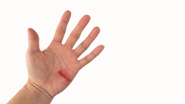 cut and wounded hand, white background - wound blood human finger human hand imagens e fotografias de stock