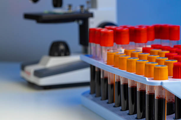 istock Blood test tubes in lab close up 1312382155