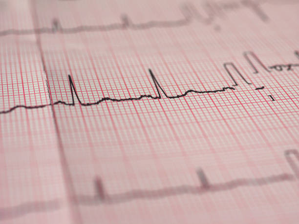 istock Electrocardiography of heart beat 1312441829
