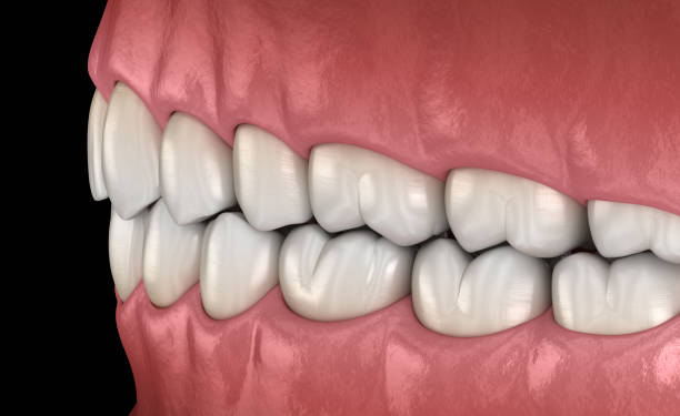 istock Healthy human teeth with normal occlusion. Medically accurate tooth 3D illustration 1312577681