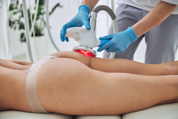 istock Unrecognized lady lying on medicine table while getting anti-fat treatment in spa salon 1312587694